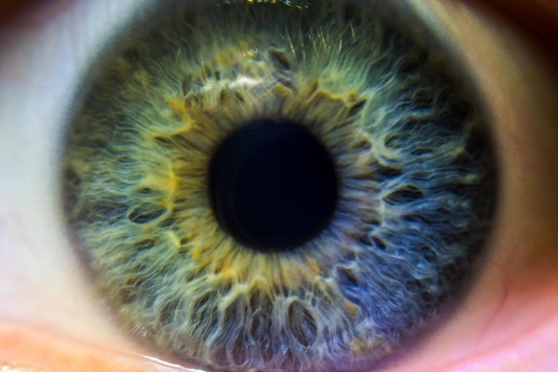 Femto-LASIK